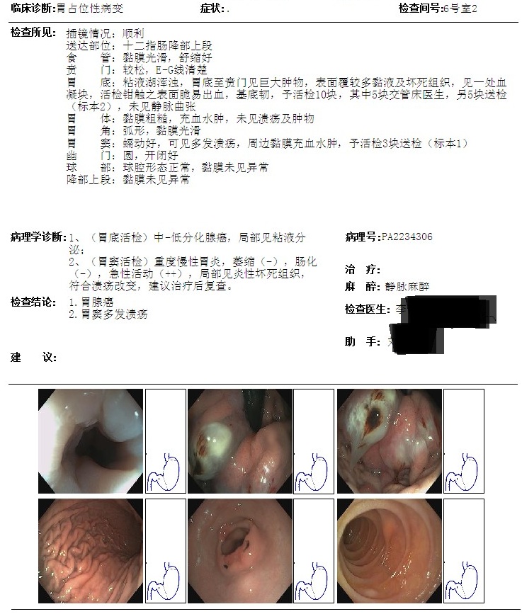 胃镜报告.jpg
